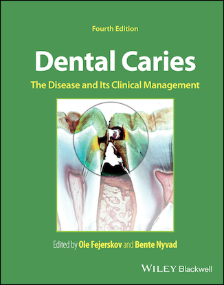 عکس Dental Caries: The Disease and its Clinical Management 4th Edition 2025