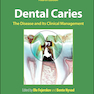 Dental Caries: The Disease and its Clinical Management 4th Edition 2025
