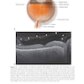 2024-2025 Basic and Clinical Science Course, Section 12: Retina and Vitreous