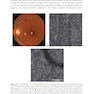 2024-2025 Basic and Clinical Science Course, Section 12: Retina and Vitreous