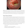2024-2025 Basic and Clinical Science Course, Section 12: Retina and Vitreous