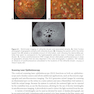 2024-2025 Basic and Clinical Science Course, Section 12: Retina and Vitreous