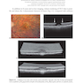 2024-2025 Basic and Clinical Science Course, Section 12: Retina and Vitreous