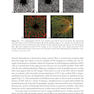 2024-2025 Basic and Clinical Science Course, Section 12: Retina and Vitreous