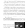 2024-2025 Basic and Clinical Science Course, Section 12: Retina and Vitreous