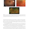 2024-2025 Basic and Clinical Science Course, Section 12: Retina and Vitreous