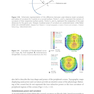 2024-2025 Basic and Clinical Science Course, Section 13: Refractive Surgery