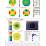 2024-2025 Basic and Clinical Science Course, Section 13: Refractive Surgery