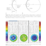 2024-2025 Basic and Clinical Science Course, Section 13: Refractive Surgery