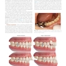 Diagnosis and Treatment Planning in Dentistry 4th Edition 2024