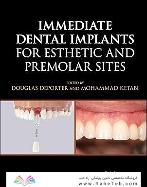 Immediate Dental Implants for Esthetic and Premolar Sites 1st Edition