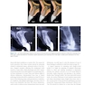 Immediate Dental Implants for Esthetic and Premolar Sites 1st Edition