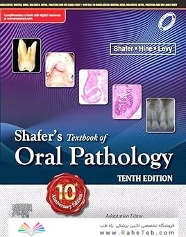 Shafer