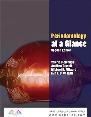 Wiley-Blackwell Periodontology at a Glance