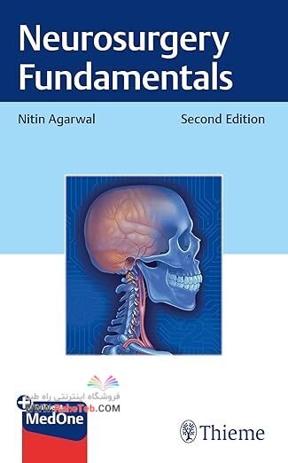 Neurosurgery Fundamentals 2nd Edition
