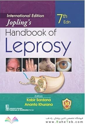 Joplings Handbook Of Leprosy 7Ed International Edition