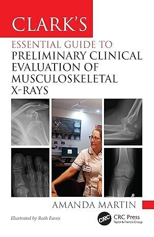 عکس Clark’s Essential Guide to Preliminary Clinical Evaluation of Musculoskeletal X-rays: Evaluating and Commenting on Images