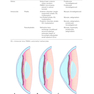 2025-2026 Basic and Clinical Science Course, Section 13: Refractive Surgery