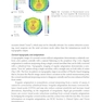 2025-2026 Basic and Clinical Science Course, Section 13: Refractive Surgery