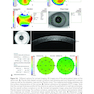 2025-2026 Basic and Clinical Science Course, Section 13: Refractive Surgery
