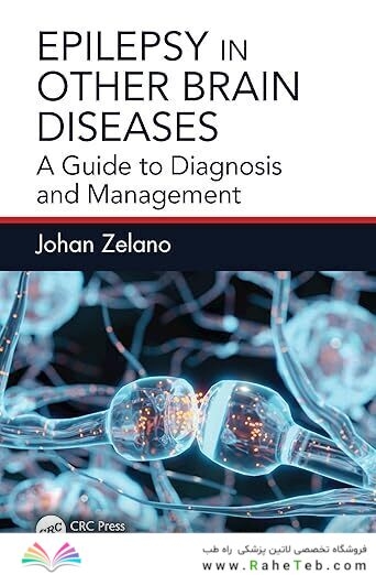 Epilepsy in Other Brain Diseases: A Guide to Diagnosis and Management 1st Edition