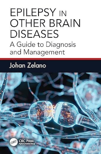 عکس Epilepsy in Other Brain Diseases: A Guide to Diagnosis and Management 1st Edition