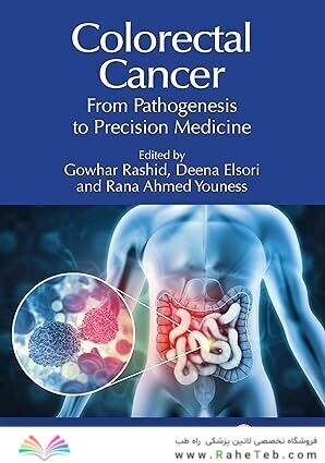 Colorectal Cancer: From Pathogenesis to Precision Medicine 1st Edition
