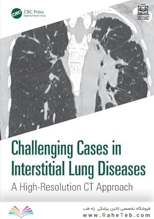 Challenging Cases in Interstitial Lung Diseases: A High-resolution Ct Approach