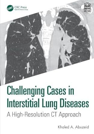 عکس Challenging Cases in Interstitial Lung Diseases: A High-resolution Ct Approach