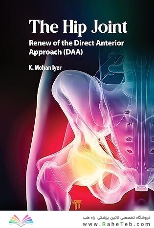 The Hip Joint