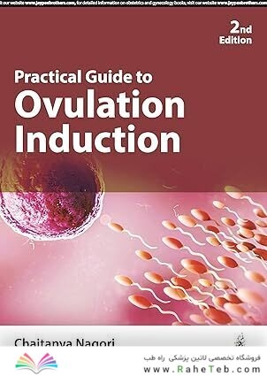 Practical Guide to Ovulation Induction