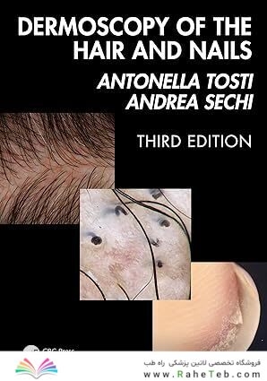 Dermoscopy of the Hair and Nails  3rd Edition
