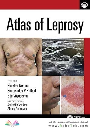 Atlas of Leprosy 1st Edition