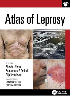 عکس Atlas of Leprosy 1st Edition