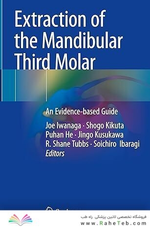 Extraction of the Mandibular Third Molar: An Evidence-based Guide