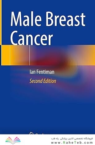 Male Breast Cancer