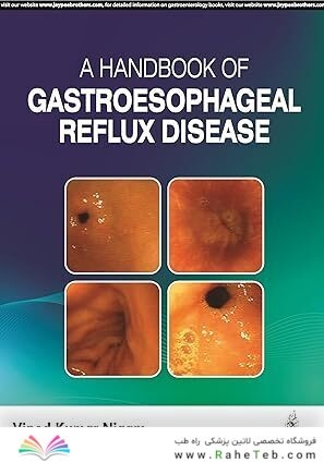 A Handbook of Gastroesophageal Reflux Disease
