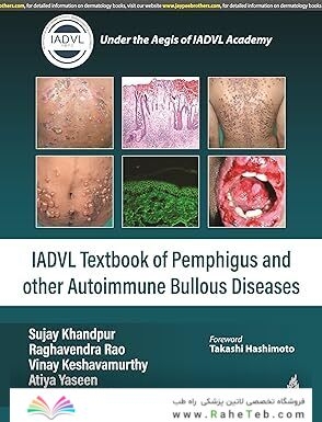 IADVL TEXTBOOK OF PEMPHIGUS AND OTHER AUTOIMMUNE BULLOUS DISEASES