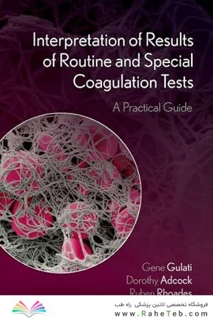 Interpretation of Results of Routine and Special Coagulation Tests: A Practical Guide
