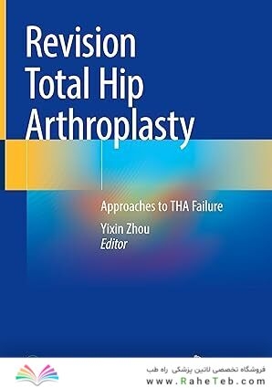 Revision Total Hip Arthroplasty: Approaches to THA Failure