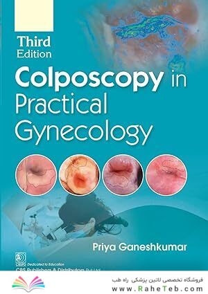 Colposcopy In Practical Gynecology