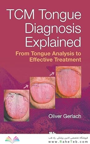 Tcm Tongue Diagnosis Explained