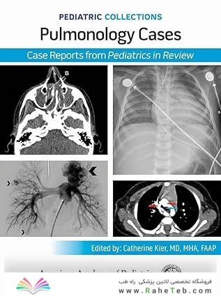 Pediatric Collections: Pulmonology Cases