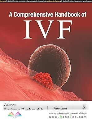 A COMPREHENSIVE HANDBOOK OF IVF