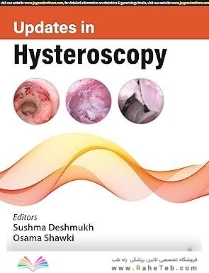 UPDATES IN HYSTEROSCOPY