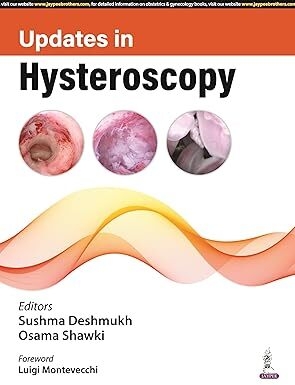 عکس UPDATES IN HYSTEROSCOPY