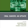 Oral Cancer: An Update, An Issue of Dental Clinics of North America