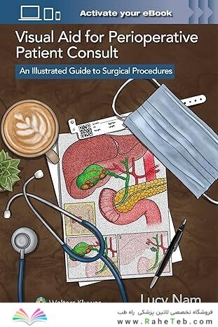 Visual Aid for Perioperative Patient Consult: An Illustrated Guide to Surgical Procedures