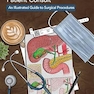 Visual Aid for Perioperative Patient Consult: An Illustrated Guide to Surgical Procedures