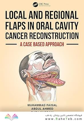 Local and Regional Flaps in Oral Cavity Cancer Reconstruction: A case-based approach 1st Edition